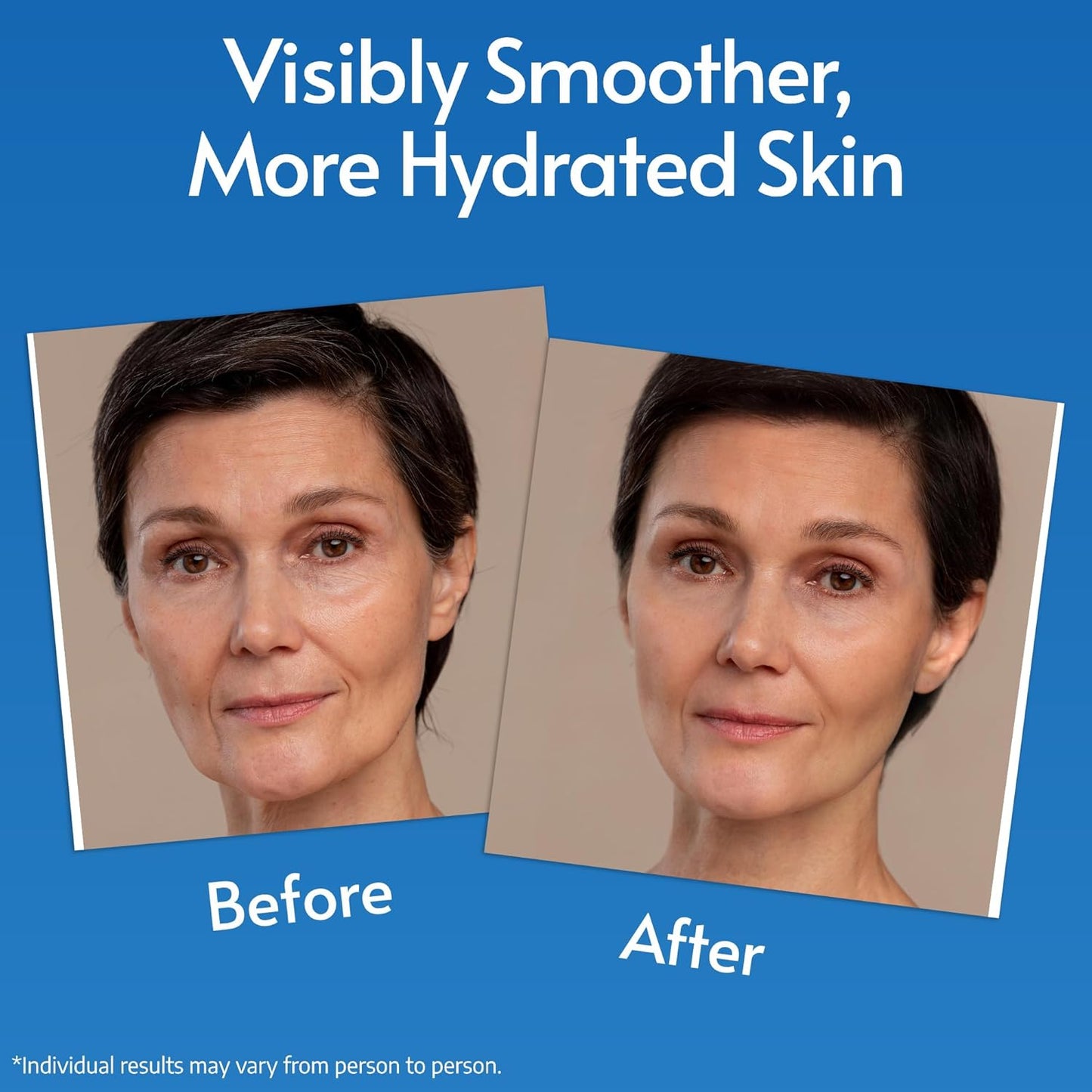 Hyaluronic Acid Serum for Face with Vitamin C & E | Microneedling Serum for Derma Roller | Anti Aging Hydrating Serum | Anti Wrinkle and Solution for Acne Scars | 60 ml