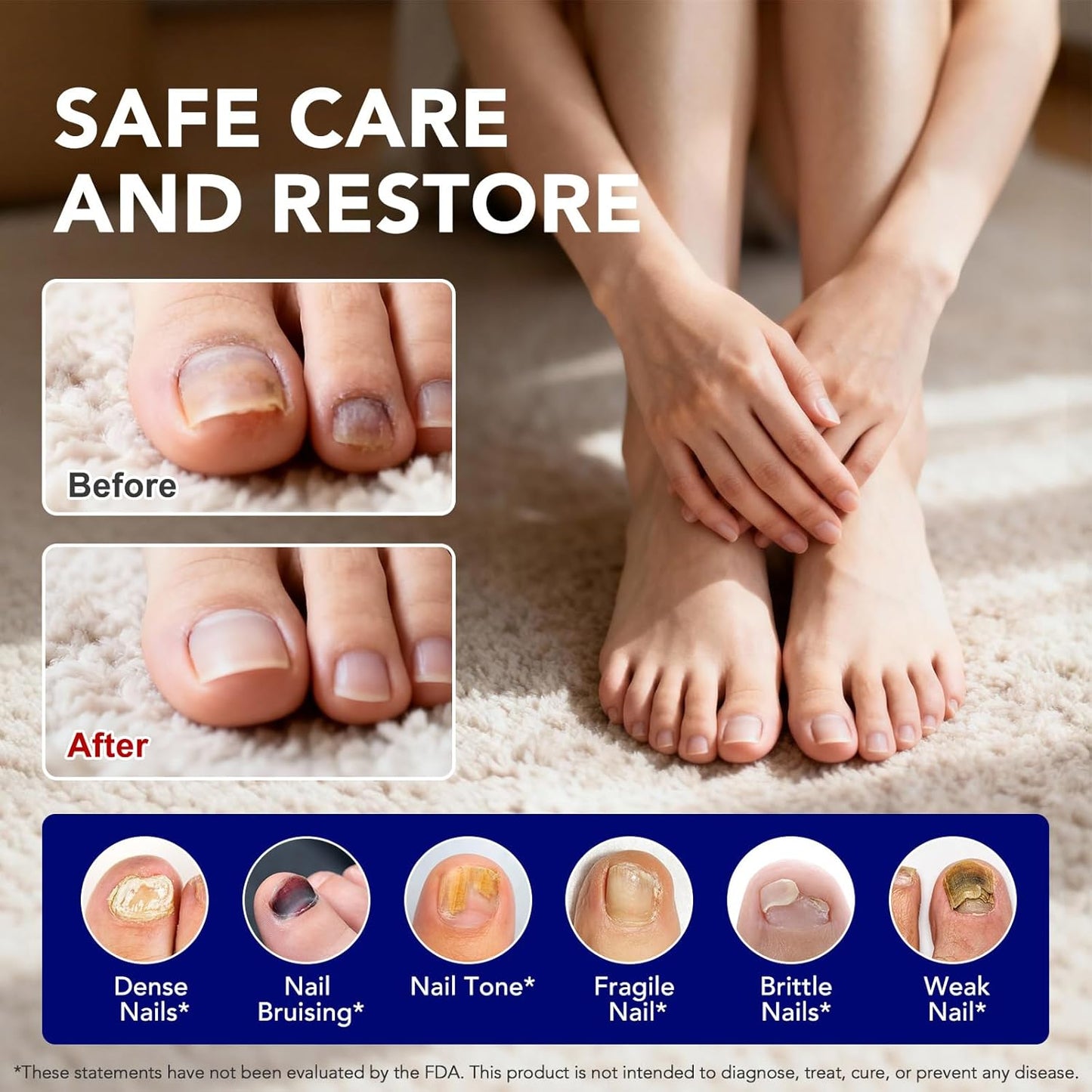 Nail Fungus Pen, 4-Pack Toenail Fungus Treatment Pen, Natural Plant Extracts Nail Repair Pen For Damaged, Broken & Thick Nails Toenails