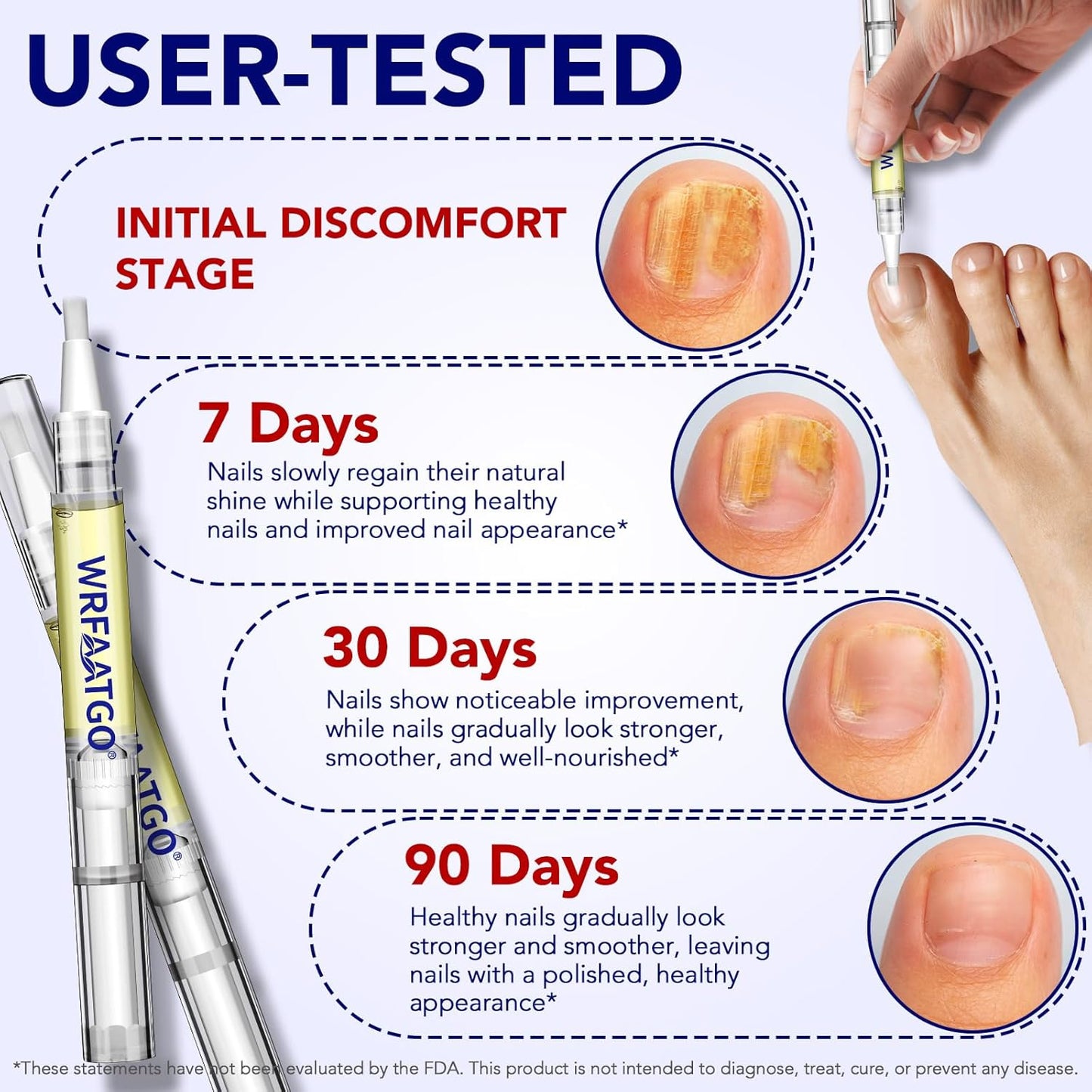 Nail Fungus Pen, 4-Pack Toenail Fungus Treatment Pen, Natural Plant Extracts Nail Repair Pen For Damaged, Broken & Thick Nails Toenails