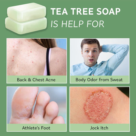 Tea Tree Soap Bar – Deep Cleansing Botanical Bar with Tea Tree, Eucalyptus & Lavender Oils – Gently Soothes Skin Prone to Discomfort, Odour, or Dryness – 2 x 116g
